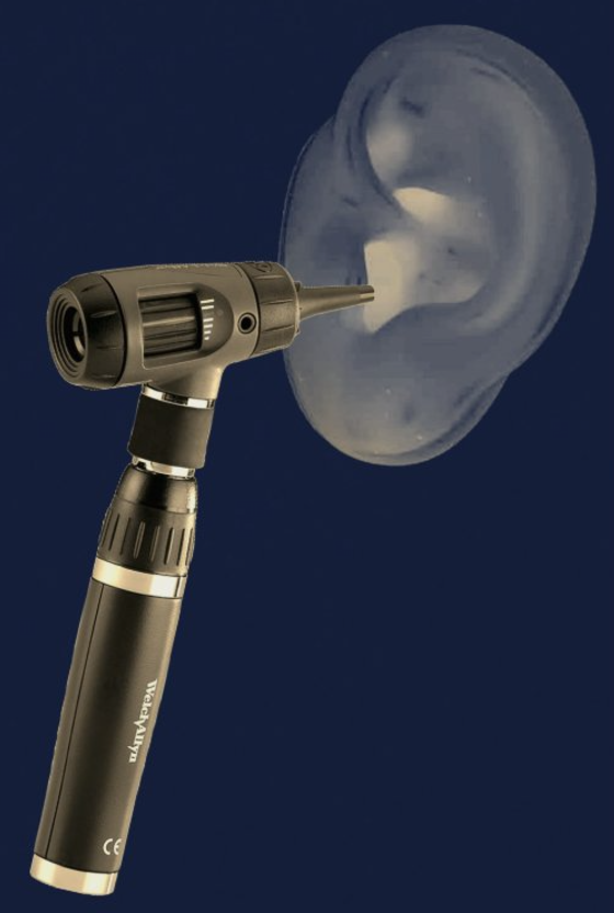 Welch Allyn otoscope
